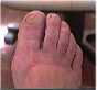 Le pied et les ongles sont surveills par le pdicure-podologue